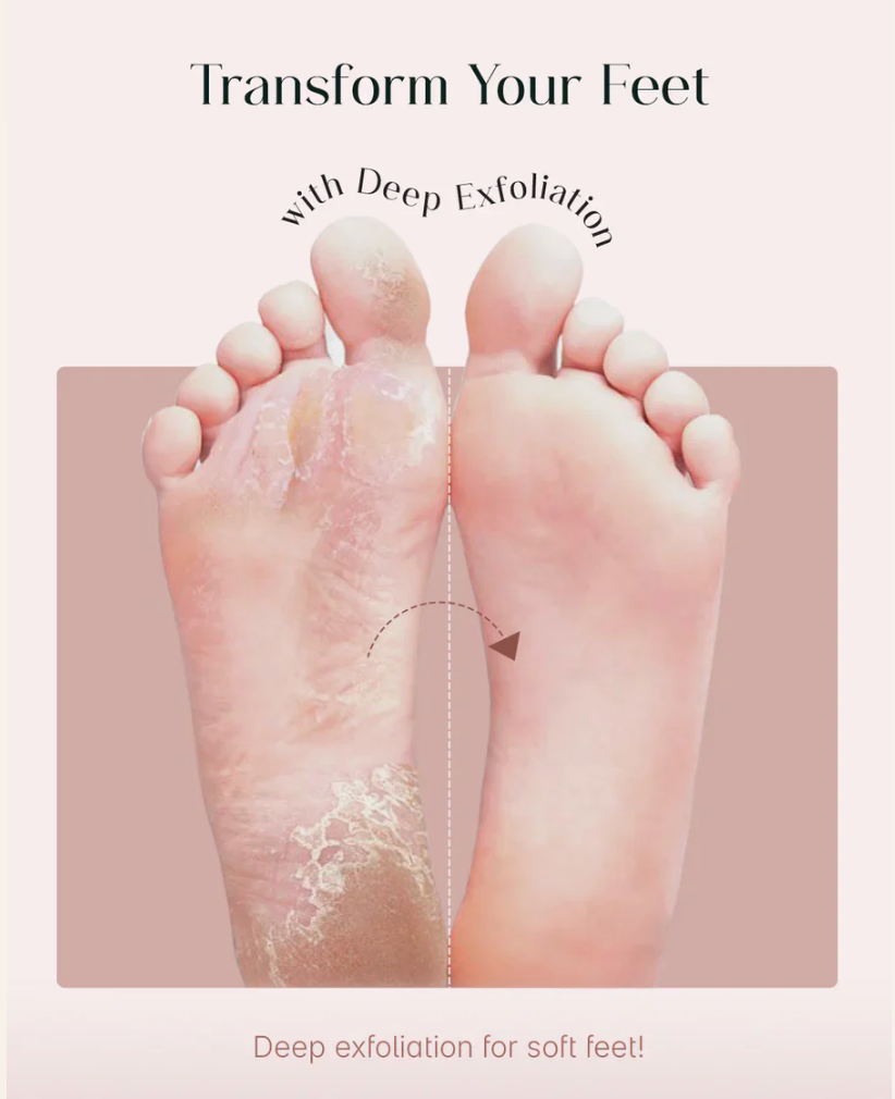 Peeldo Exfoliating Foot Mask Hydrating Sock