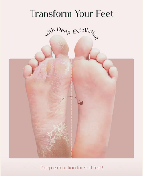 Peeldo Exfoliating Foot Mask Hydrating Sock